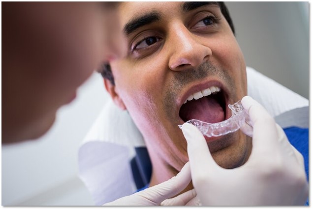 Benefits of Invisalign