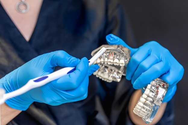 Customizing Invisalign Trays