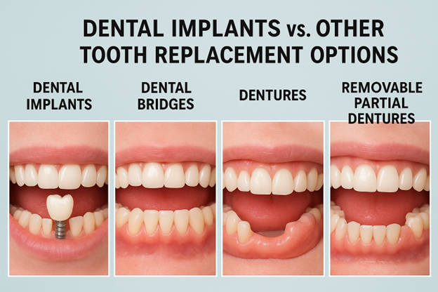 Dental Implants & Other Options