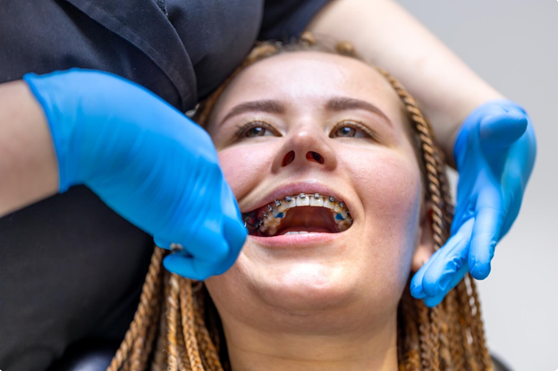 Invisalign braces comparison