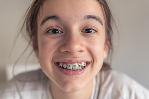 teenage girl with braces