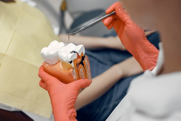 benefits of dental implants