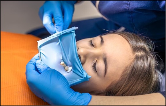 fluoride treatments