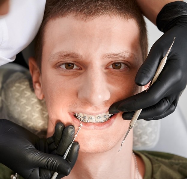Traditional Braces
